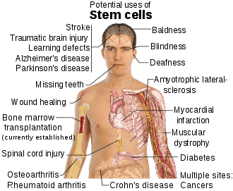 Stem cell_treatments